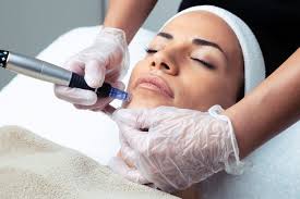 Formation ebook Microneedling